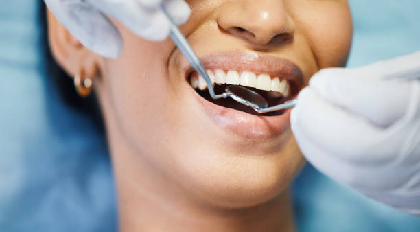 Best Walk-In Emergency Dental Services in Jena, LA
